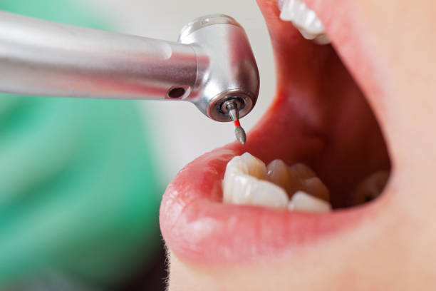 Best Emergency Dental Extractions in Kenedy, TX